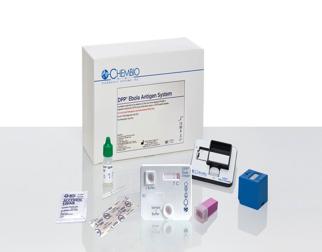 Image: DPP Ebola Antigen System is a 15 minute rapid test for detection of Ebola Virus Specific Antigen (Photo courtesy of Chembio Diagnostic Systems).