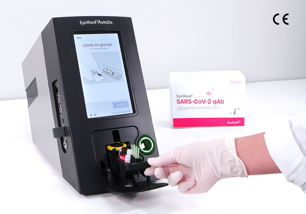 Image: Epithod AutoDx analyzer and Epithod SARS-CoV-2 qAb antibody test kit (Photo courtesy of DxGen Corp.)