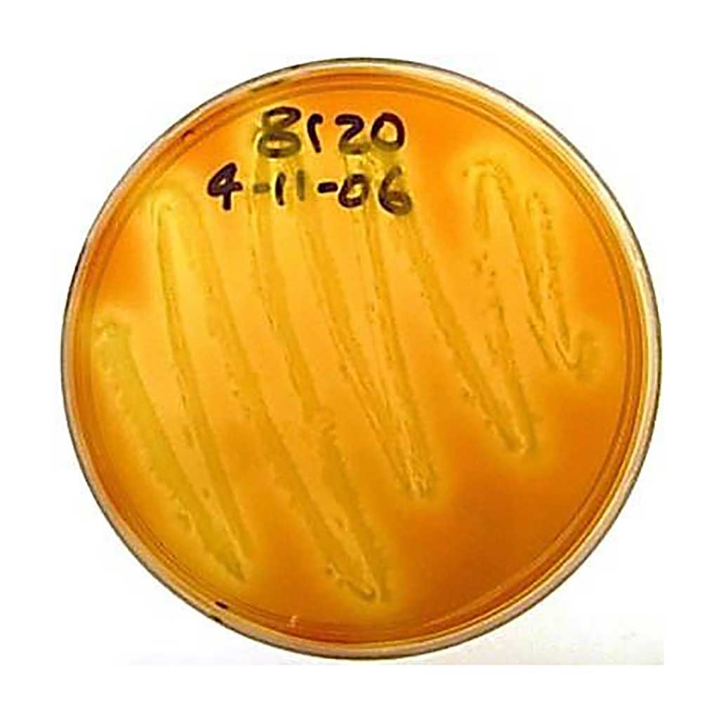 Image: Yellow color shows thiamine degradation on an agar plate of cultured Paenibacillus thiaminolyticus (Photo courtesy of Catherine A. Richter, PhD).