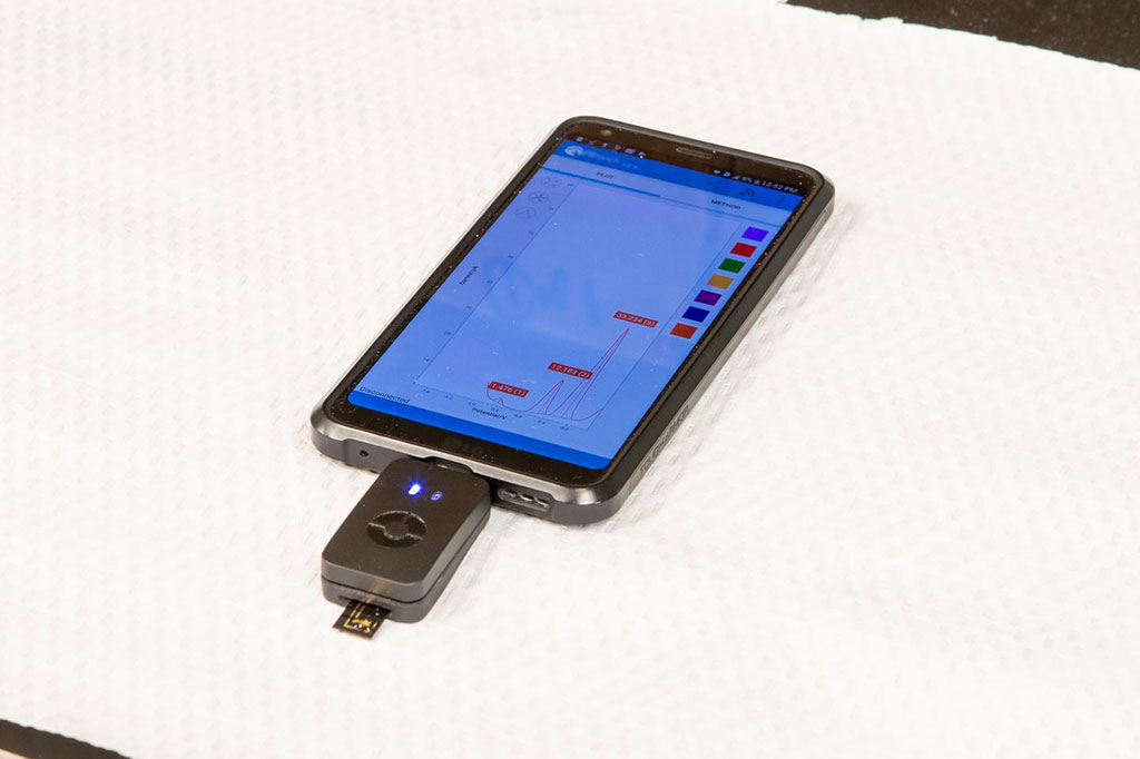 Image: A recently developed electrochemical bio‐barcode device paired with a smartphone enables cancer patients to read critical biomarker levels at home in samples of self-drawn blood (Photo courtesy of Georgia Kirkos, McMaster University)