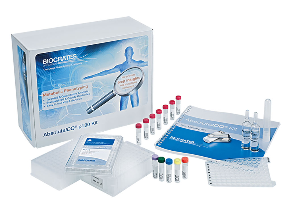 Image: The AbsoluteIDQ p180 kit provides scientists with highly reproducible metabolomics data to confidently obtain detailed knowledge about the metabolic phenotypes in their studies (Photo courtesy of BIOCRATES Life Sciences).