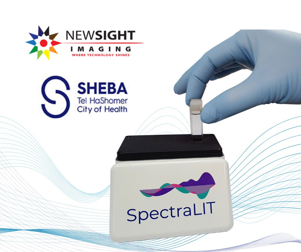 Image: SpectraLIT device (Photo courtesy of Newsight Imaging Ltd.)