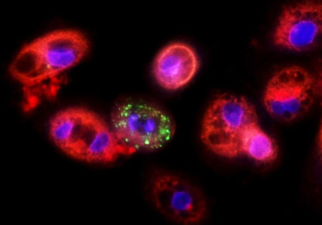 Image: Lung cells infected with coronavirus (Photo courtesy of The Hebrew University of Jerusalem).