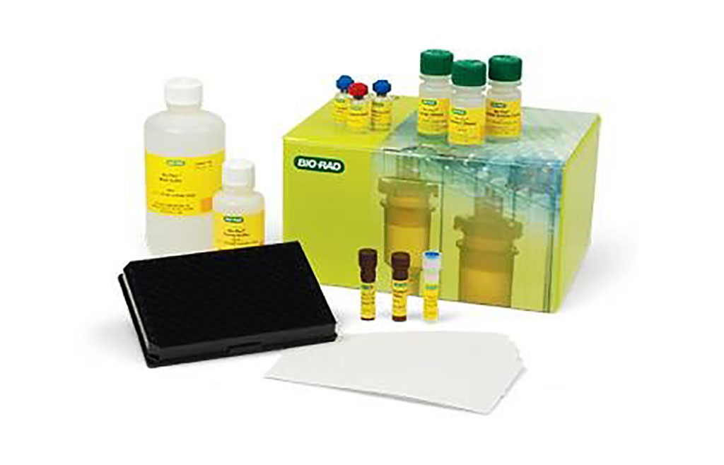 Image: The Bio-Plex Pro Human Th17 Cytokine Panel enables measurement of analytes in diverse matrices such as serum, plasma, and cell culture supernatants (Photo courtesy of Bio-Rad).