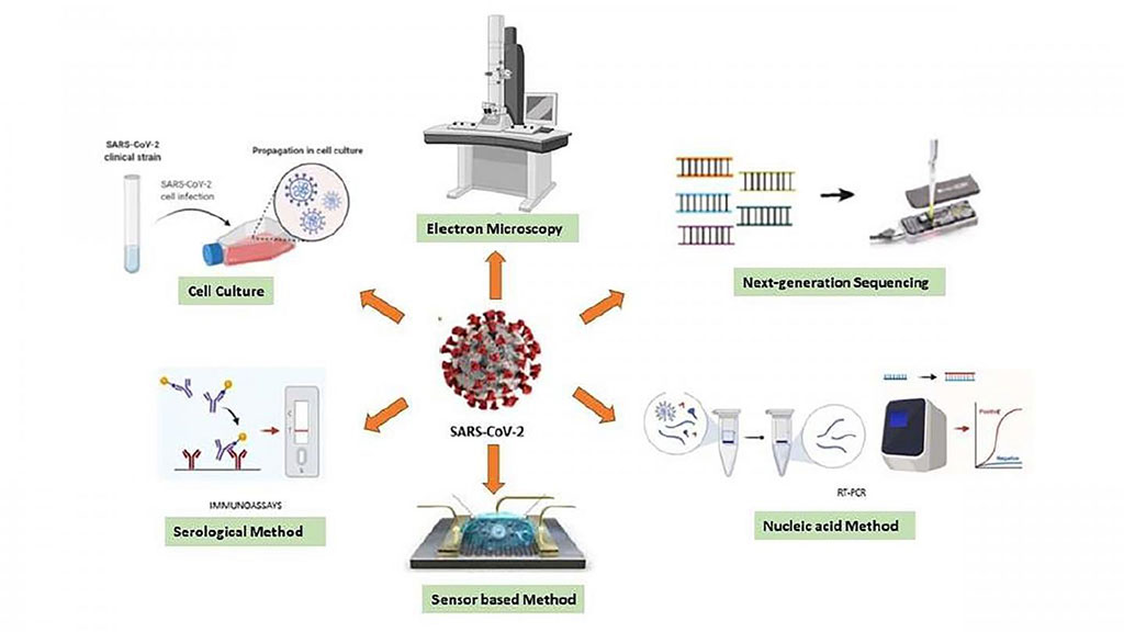 Image: Various diagnostic techniques can be used for sensing the RNA of SARS-CoV-2 (Photo courtesy of Saadet Alpdagtas and Elif Ilhan)