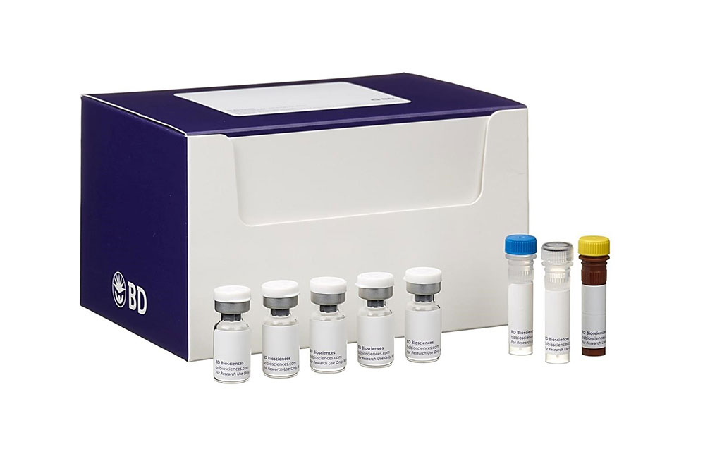 Image: BD enzyme-linked immunosorbent assays for natural C5b-9 in serum, plasma, and other biological samples (Photo courtesy of BD Biosciences).