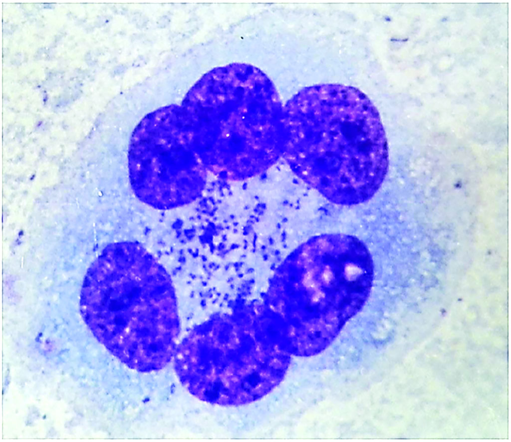 Image: Orientia tsutsugamushi present in the liquid scraped from the abdominal wall of an infected mouse. The abdominal walls of the infected mouse were fixed and stained with Giemsa stain and presence of O. tsutsugamushi particles (purple particles) detected by light microscopy (Photo courtesy of University of Illinois, Urbana-Champaign).