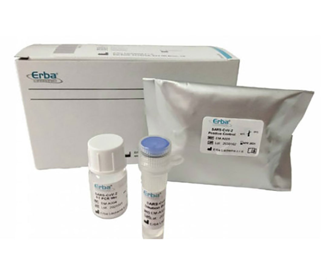 Image: ErbaMDx SARS-CoV-2 RT-PCR Kit (Photo courtesy of Erba Mannheim)