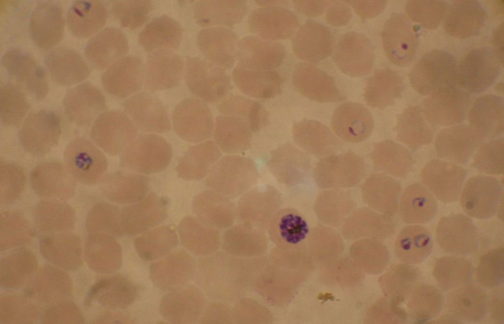 Image: Blood smear from a P. falciparum culture: several red blood cells have ring stages inside them while close to the center is a schizont and on the left a trophozoite (Photo courtesy of Wikimedia Commons)