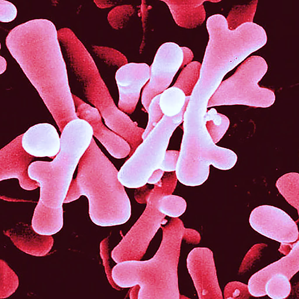 Image: False-colored electron microscopic image of Bifidobacterium that are one of the major genera of bacteria that make up the gastrointestinal tract and are associated with variants in the lactase gene locus (Photo courtesy of The Keck Science Department of the Claremont Colleges)