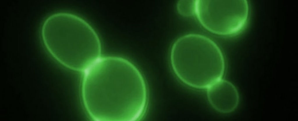 Image: Based on a reaction between yeast and the novel coronavirus, the test will rapidly detect the presence of SARS-CoV-2 in saliva and will be available by mid-2021 (Photo courtesy of BIOinFOOD)