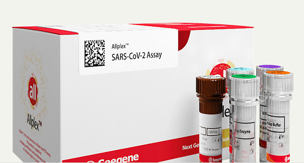 Image: Allplex SARS-CoV-2 Master Assay (Photo courtesy of Seegene, Inc.)