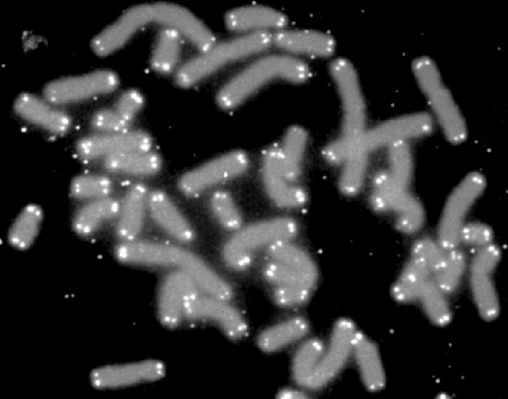 Image: Human chromosomes (grey) capped by telomeres (white) (Photo courtesy of U.S. Department of Energy Human Genome Program via Wikimedia Commons)