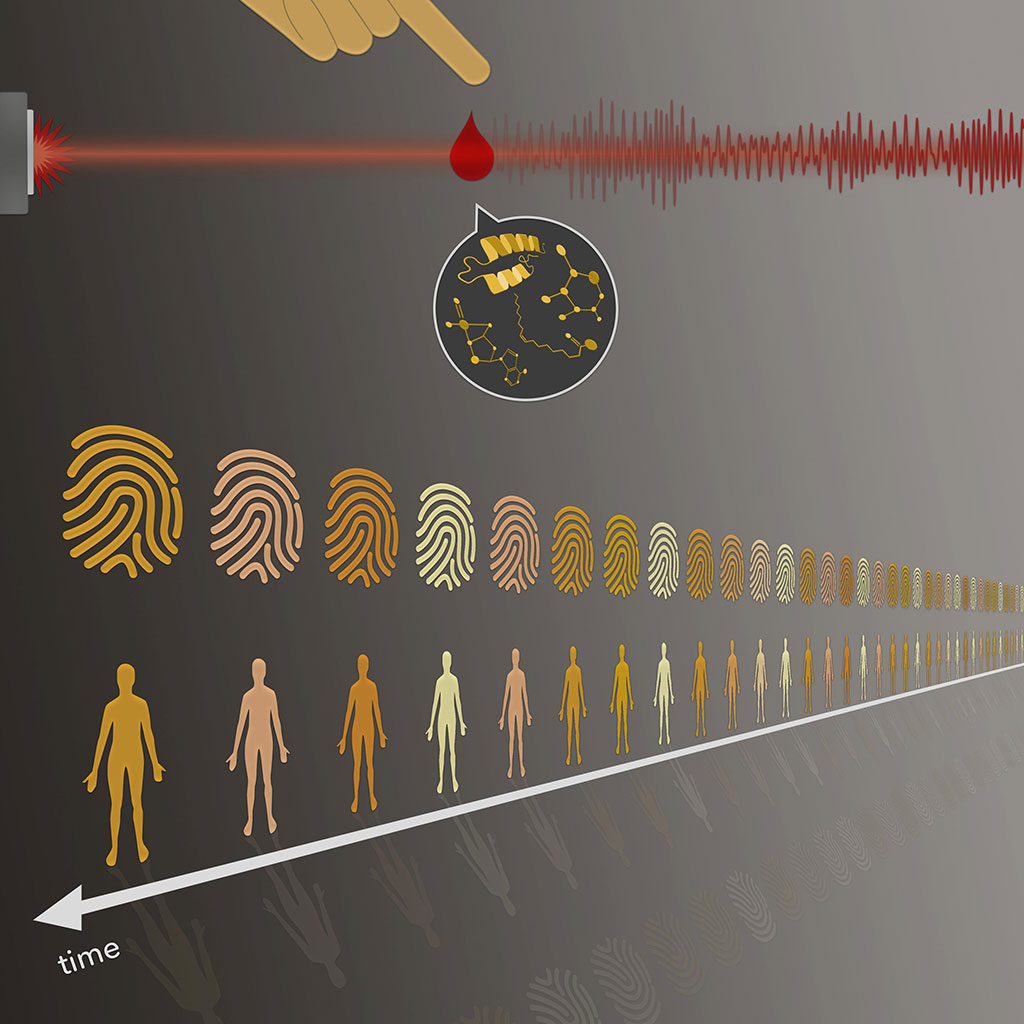Image: Blood panels are as individual as fingerprints. Investigators have now demonstrated that this so-called molecular fingerprint of the blood is stable over time (Photo courtesy of Max Planck Institute of Quantum Optics)