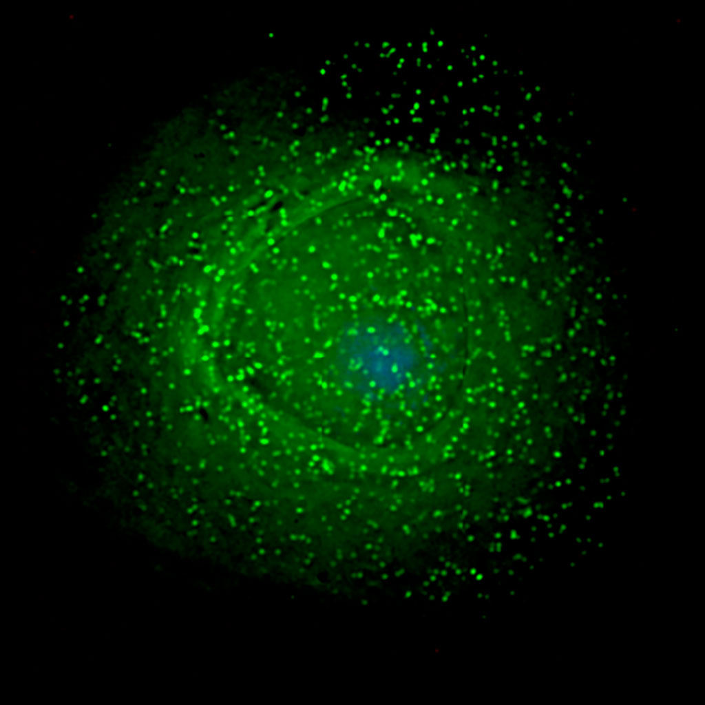 Image: HIV assembling on the surface of an infected macrophage. The HIV virions have been marked with a green fluorescent tag and then viewed under a fluorescent microscope (Photo courtesy of Wikimedia Commons)