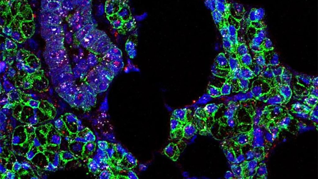 Image: SARS-CoV-2 (pink) and its preferred human receptor ACE2 (white) were found in human salivary gland cells (outlined in green) (Photo courtesy of Paola Perez, Warner Lab, National Institute of Dental and Craniofacial Research, NIH)