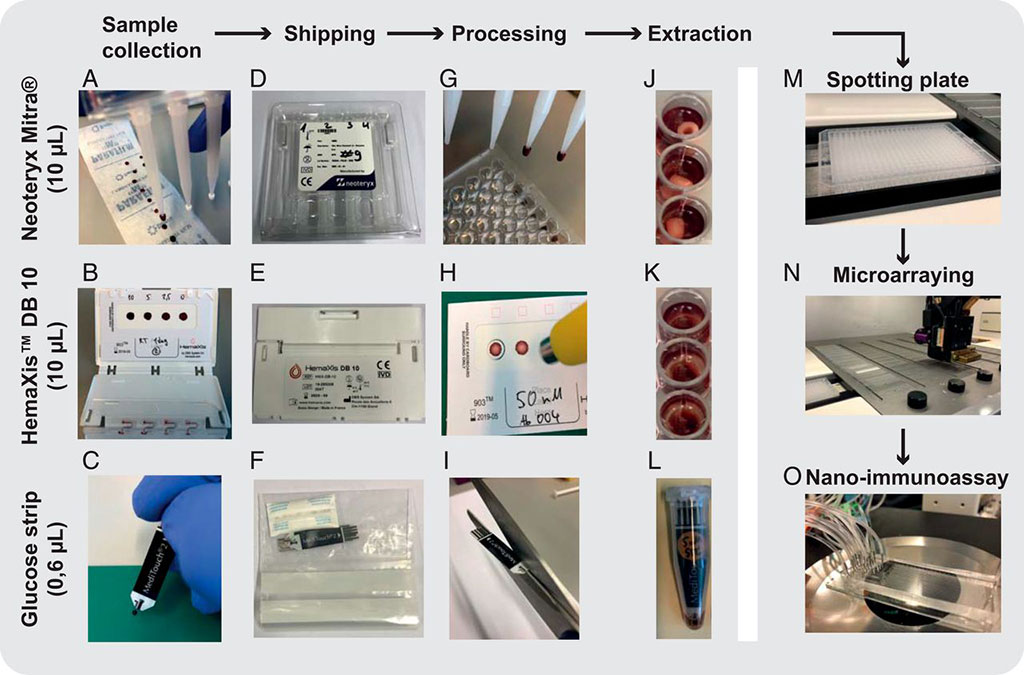 Image: Ultralow-volume whole blood sampling and processing (Photo courtesy of PNAS)