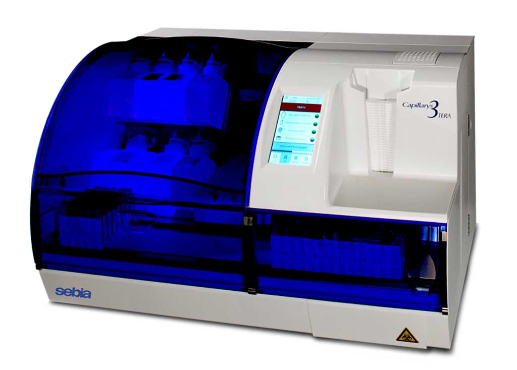 Image: The Capillarys 3 TERA is an automated analyzer based on capillary zone electrophoresis and UV detection for the quantitative analysis of Hba1c, proteins (serum and urine), immunotyping (serum and urine), and carbohydrate deficient transferrin (Photo courtesy of Sebia)