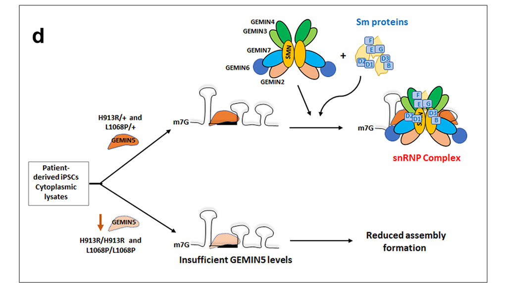 Image: Diagrammatic representation showing the possible mode of disruption in small nuclear ribonucleoproteins (snRNP) complex formation due to loss of GEMIN5 in L1068P and H913R variants