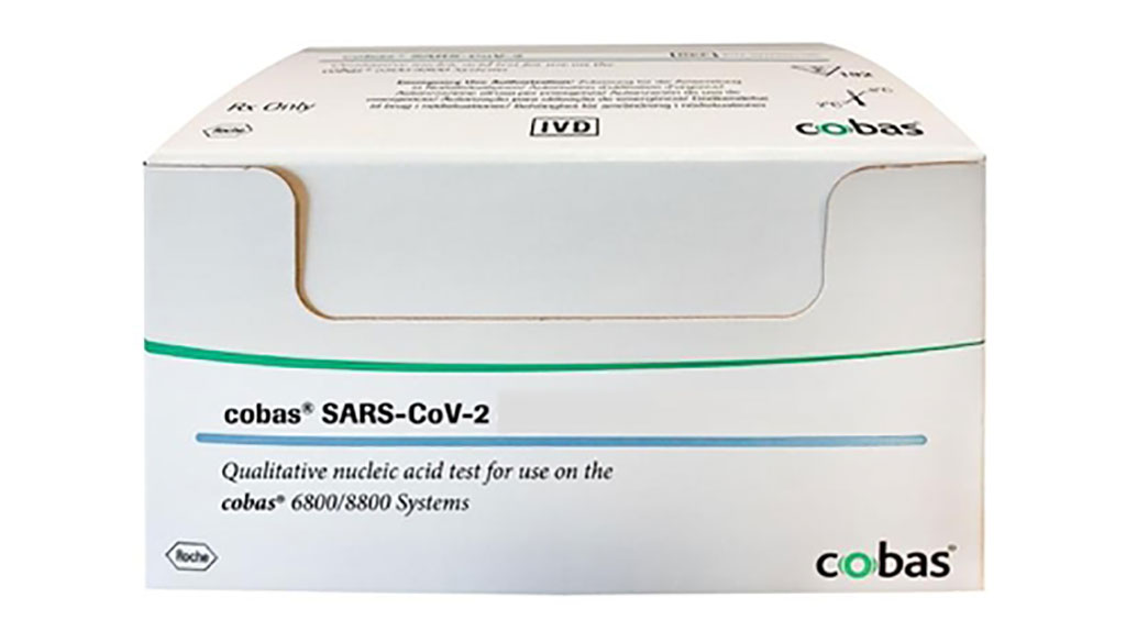 Image: cobas SARS-CoV-2 Test (Photo courtesy of Roche)