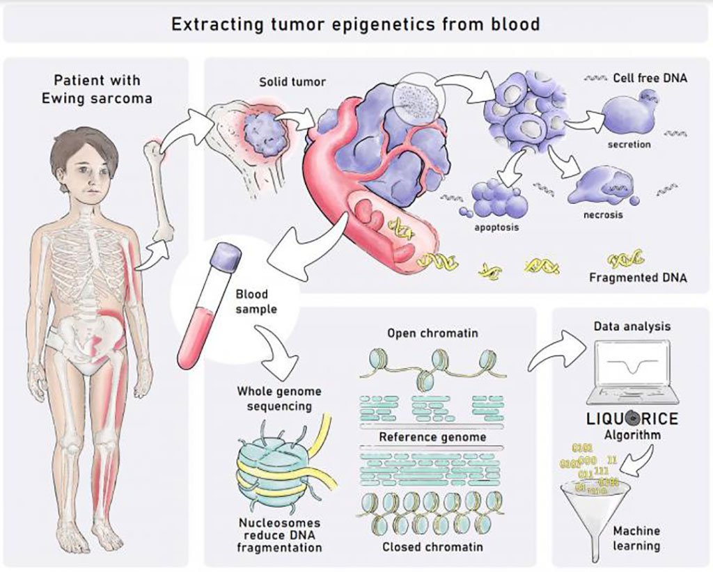 Image: Extracting tumor epigenetics from blood (Photo courtesy of Tatjana Hirschmugl)