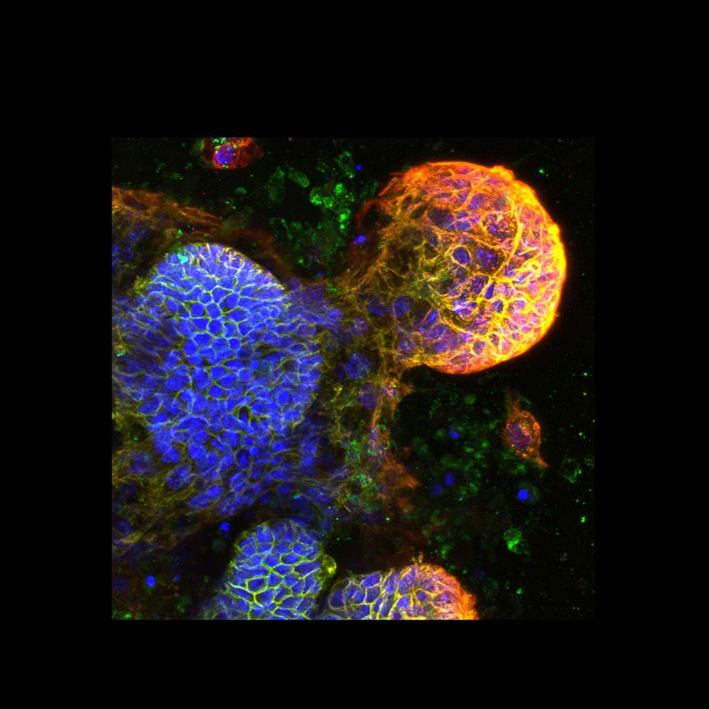 Image: Crypts and buds in the small intestine and colon (Photo courtesy of Dr. Maree Faux, Walter and Eliza Hall Institute)