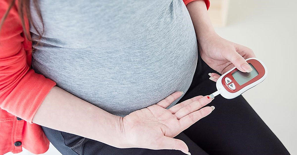 Image: Women diagnosed with gestational diabetes are more likely to be autoantibody positive and develop type 1 diabetes in the decade after delivery compared with pregnant women without gestational diabetes (Photo courtesy of Kernodle Clinic)