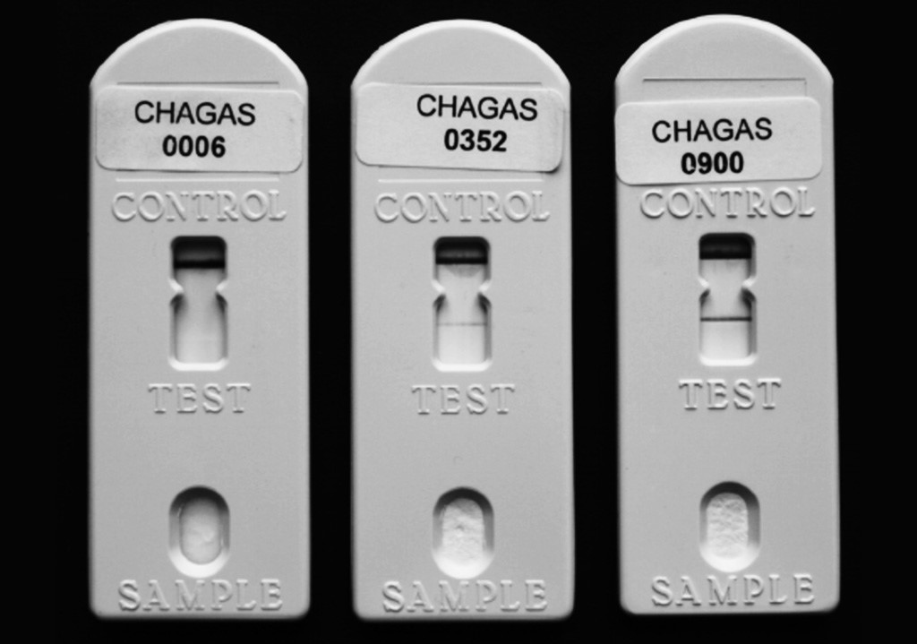 Image: Examples of negative and positive Chagas Stat-Pak RDT results. From left to right, negative, weakly positive, and strongly positive Stat-Pak results are shown (Photo courtesy of Yves Jackson)