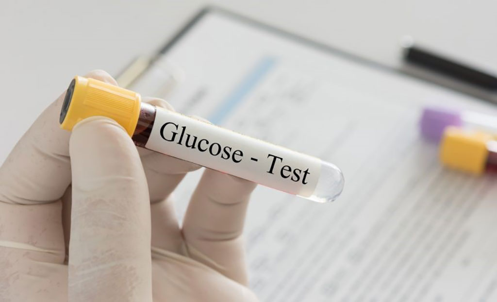 Image: A blood test for glucose may reveal hyperglycemia which has been evaluated as a risk factor in pancreatic cancer (Photo courtesy of Amit Akirov, MD)