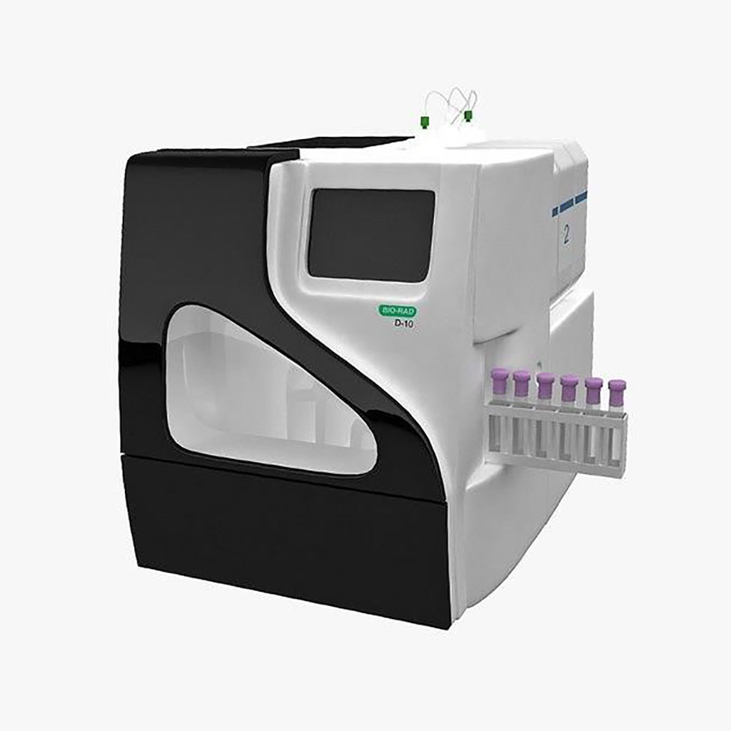 Image: The D-10 Hemoglobin Testing System provides comprehensive, automated hemoglobin testing in a compact footprint, combining HbA1c and HbA2/F/A1c testing on a single platform (Photo courtesy of Bio-Rad)