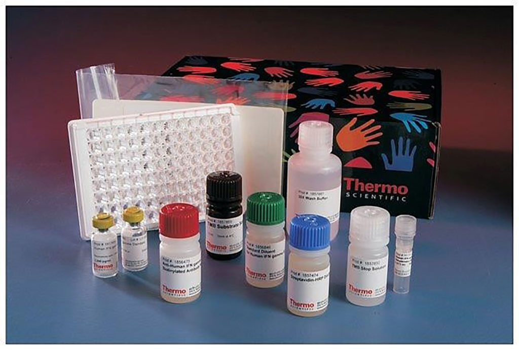 The Invitrogen Human EGF ELISA Kit measures levels of epidermal growth factor (EGF) in human serum, plasma, and cell culture supernatant using 96-well plates (Photo courtesy of Thermo Fisher Scientific)