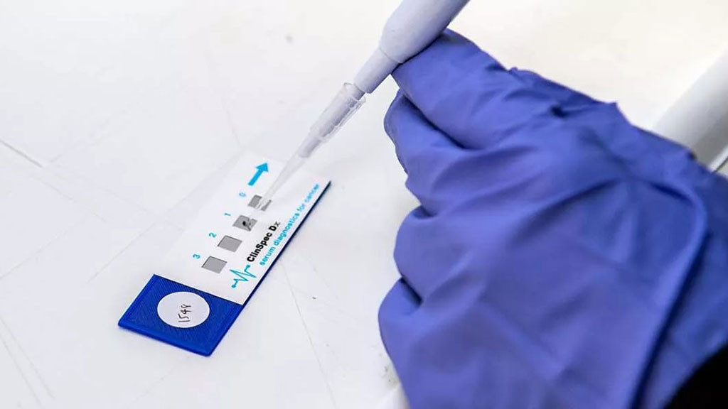 Image: Highly effective early diagnostic tests could revolutionize cancer detection.  Here, a sample is dropped onto a disposable Dxcover Slide and dried for analysis (Photo courtesy of Dxcover Limited)