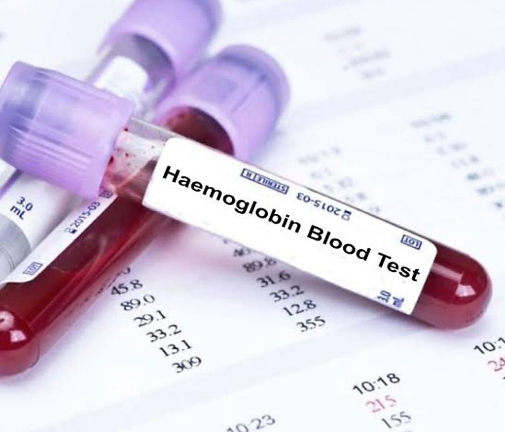 Image: Blood test for hemoglobin: cutoff levels reevaluated for anemia among healthy individuals (Photo courtesy of Glovision Diagnostics).