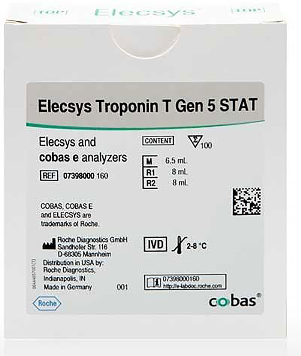Image: The Automated Elecsys Troponin T Gen 5 STAT assay facilitates the diagnosis of myocardial infarction, also in patients with COVID-19 (Photo courtesy of Roche Diagnostics)