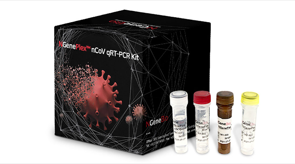 Image: NGenePlex nCoV qRT-PCR Kit (Photo courtesy of NGeneBio)