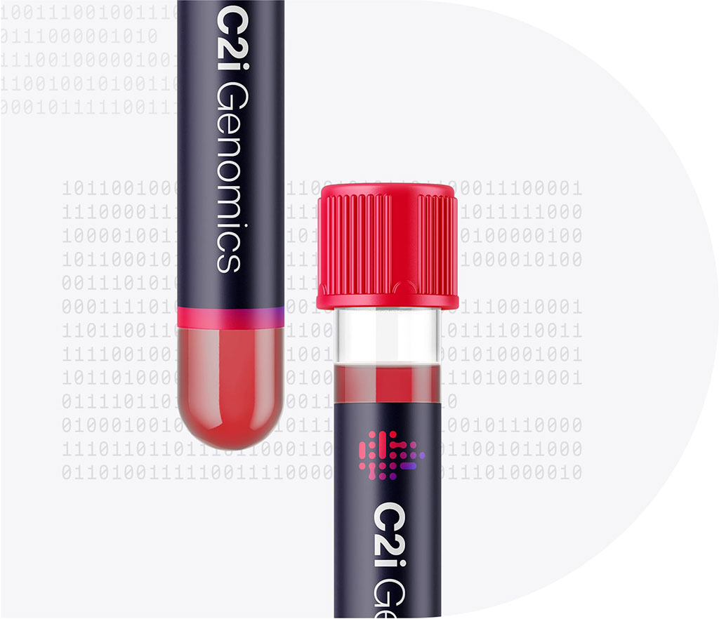 Image: C2i Genomics Blood Test (Photo courtesy of C2i Genomics)
