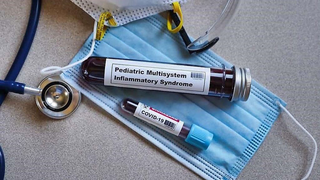 Image: Osteopontin is a biomarker for multisystem inflammatory syndrome in children (MIS-C) (Photo courtesy of Getty Images)