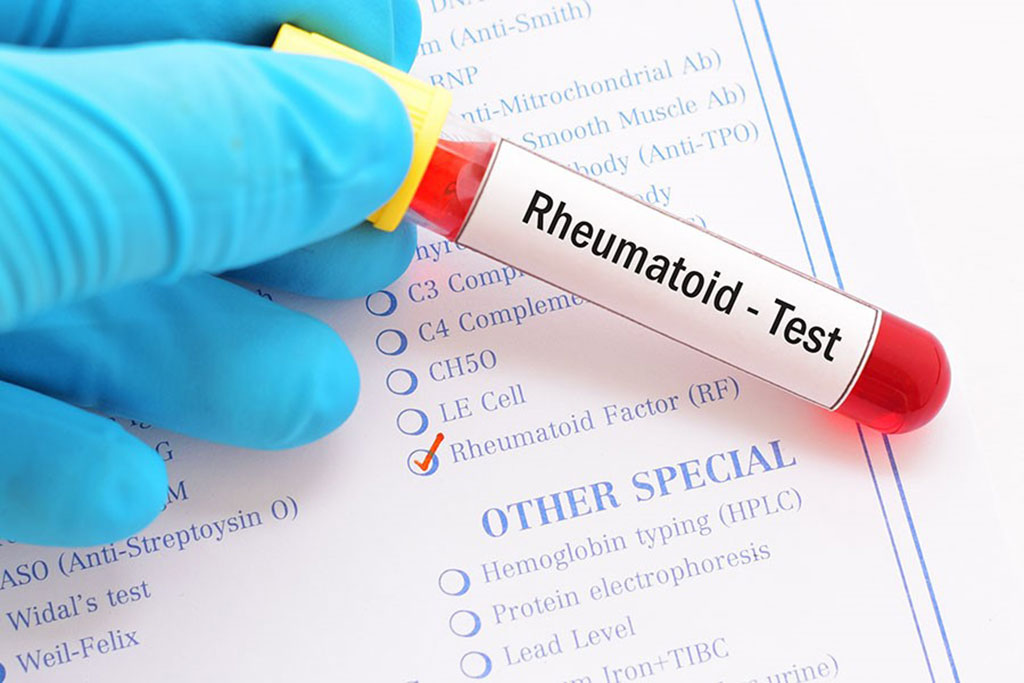 Image: There is an association between inflammation, incident heart failure, and heart failure subtypes in patients with rheumatoid arthritis (Photo courtesy of Elite Learning)