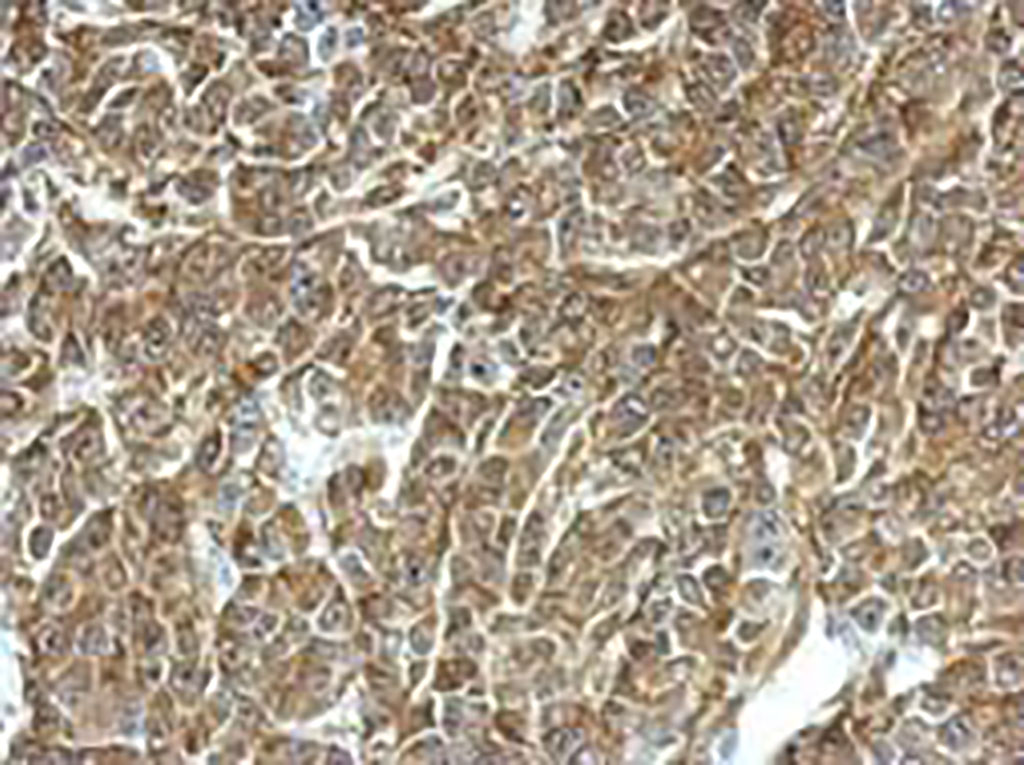 Image: Immunohistochemical analysis using a labeled antibody for TPD52 recognition (Photo courtesy of GeneTex)