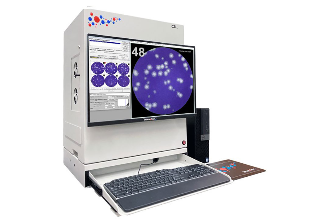 Image: The Immunospot S6 Macro M2 ELISPOT Analyzer (Photo courtesy of Cellular Technology Limited)
