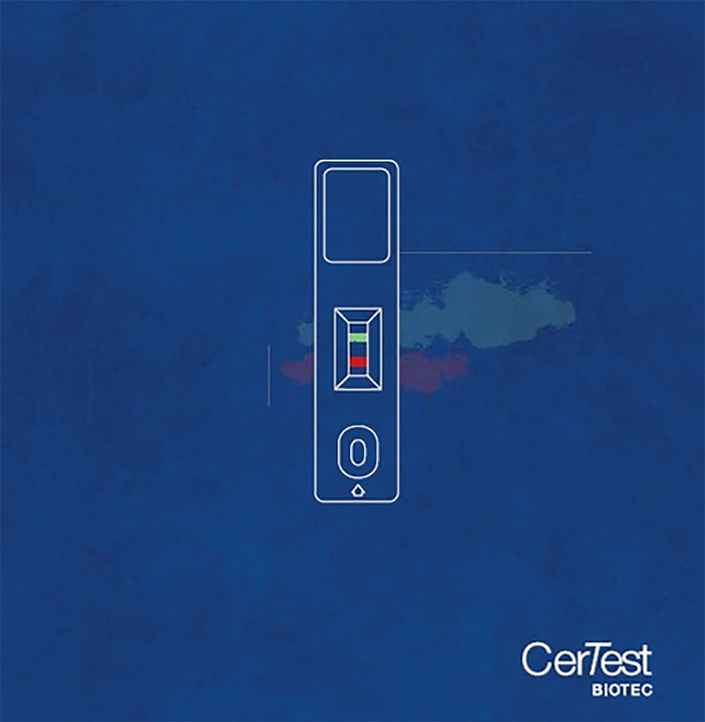 Image: CerTest Rapid test (Photo courtesy of CerTest Biotec)