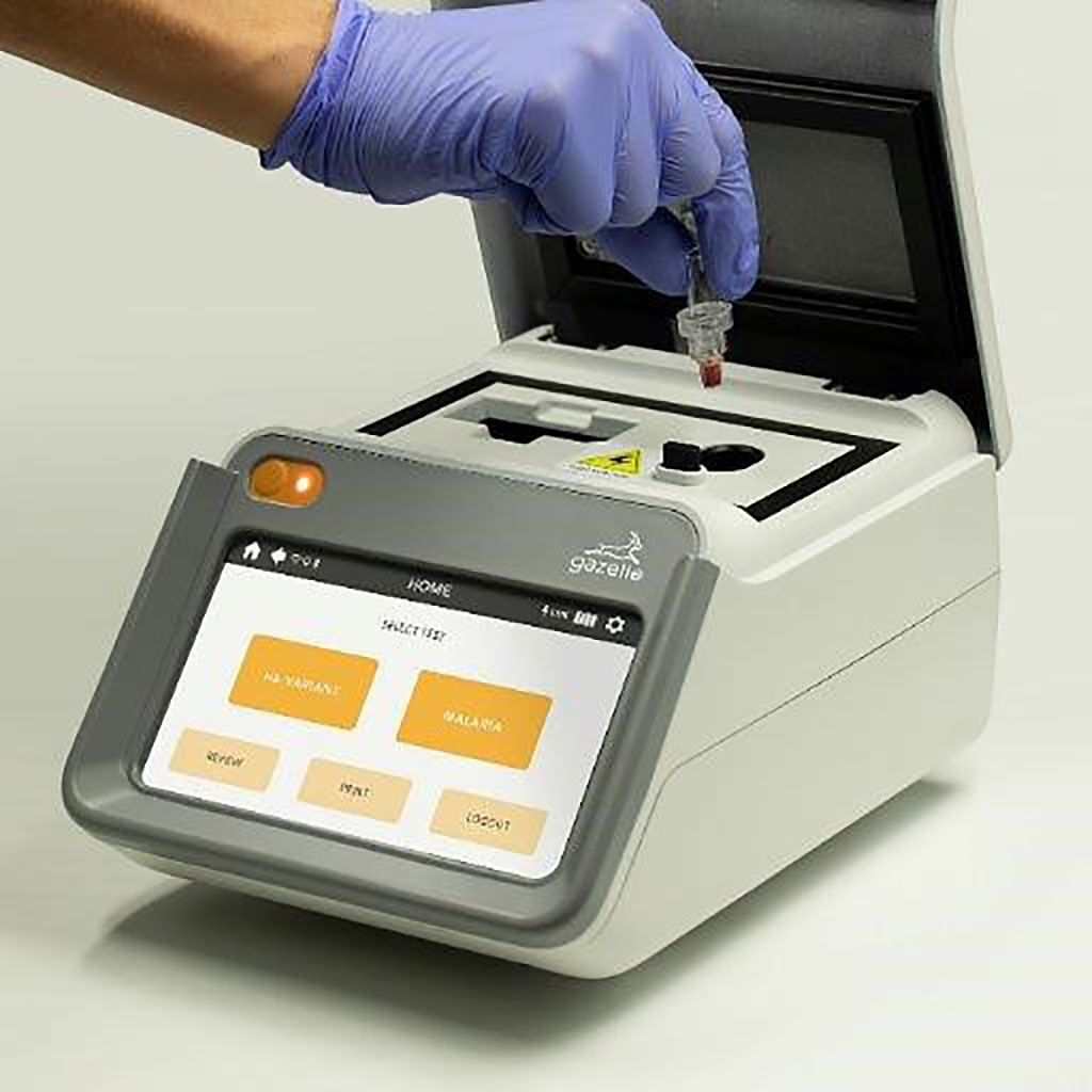 Image: The Gazelle Hb Variant Test for screening, diagnosis and management of sickle cell disease and related hemoglobinopathies at the point of care (Photo courtesy of Hemex Health)