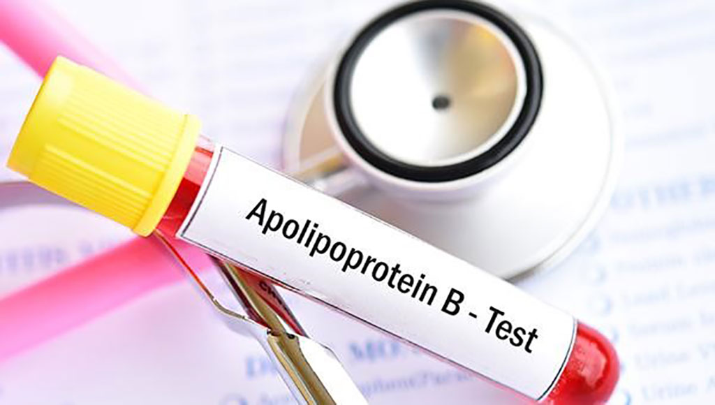 Image: Apolipoprotein B–containing lipoproteins are associated with risk of myocardial infarction in individuals with and without atherosclerosis (Photo courtesy of the Cardiovascular Research Foundation)
