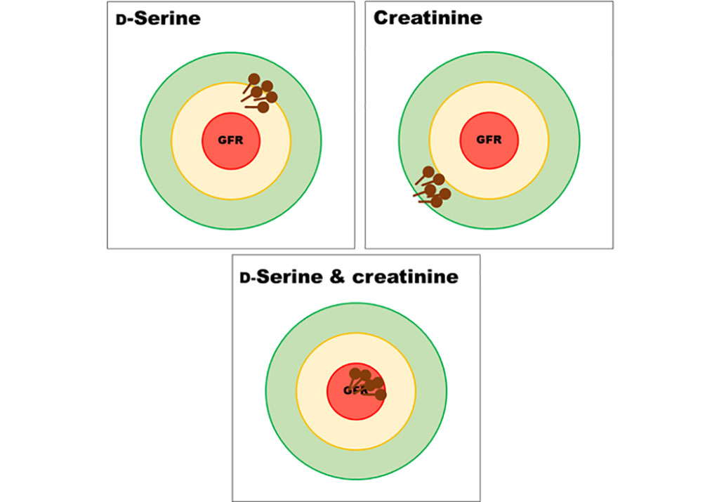 Image: D-Serine is useful for the measurement of glomerular filtration rate (GFR). The clearance of D-serine has an advantage of lower bias against GFR compared to that with the creatinine clearance. Combinational clearance measurement of D-serine and creatinine can serve as a measure of GFR with precision and low bias (Photo courtesy of Tomonori Kimura, MD, PhD)