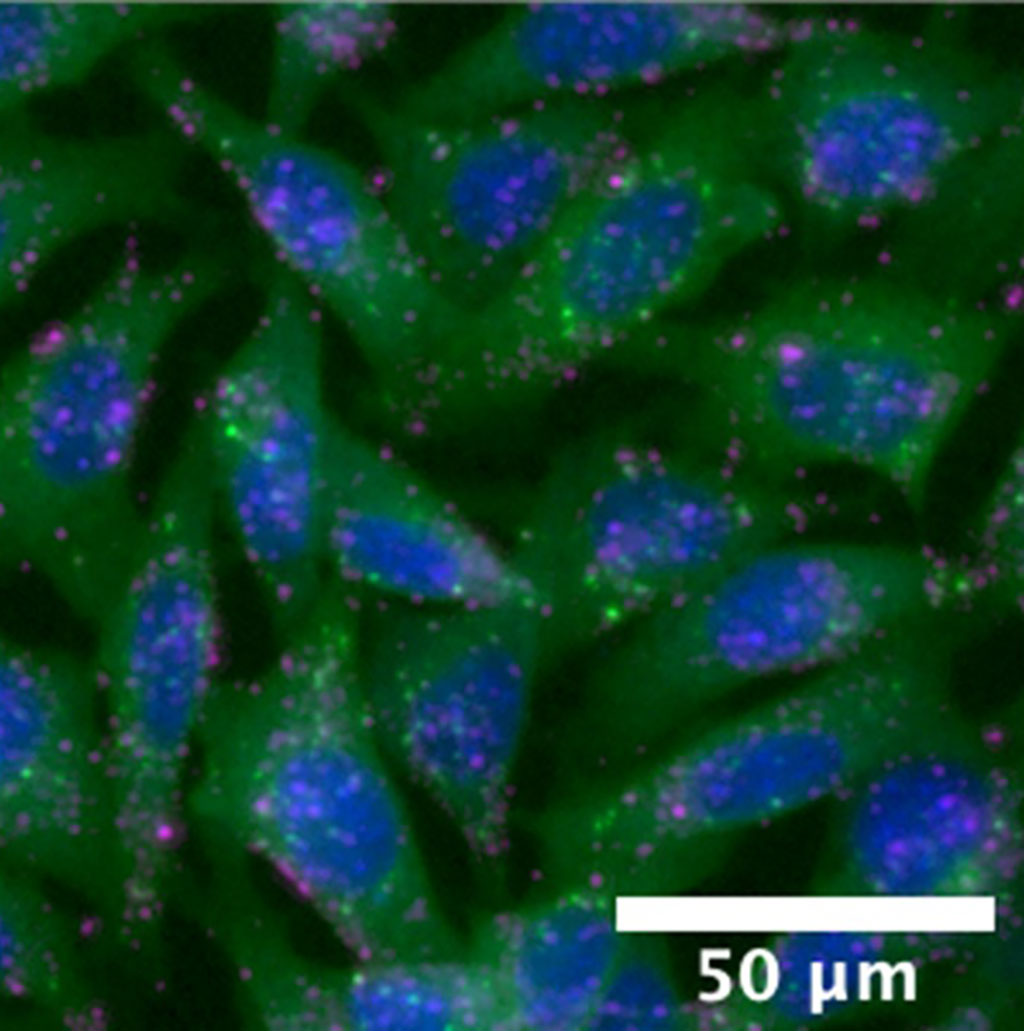 Image: Microscope image of the cells used to test nanoparticles (Photo courtesy of Jordan Green; Johns Hopkins Medicine)