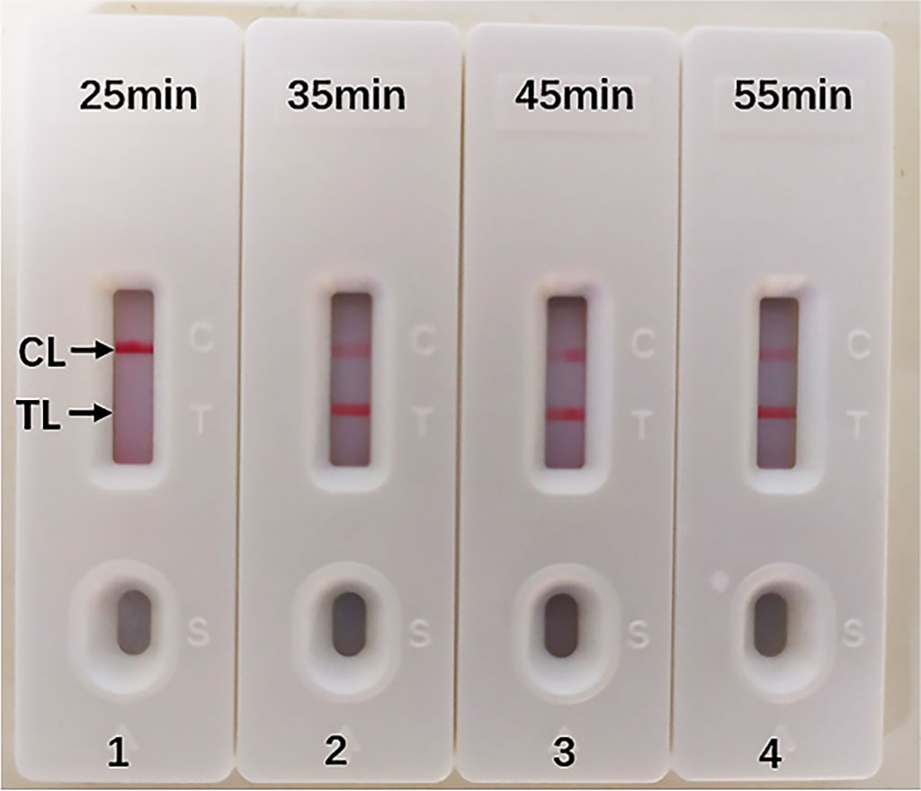 Image: Optimized reaction time for Multiple Cross Displacement Amplification (MCDA-LFB) assay to detect Legionella pneumophila. The best sensitivity was seen when the amplification lasted for 35 minutes (Photo courtesy of Zhejiang Provincial People’s Hospital)