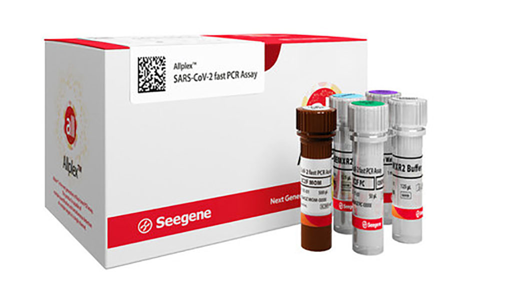 Image: Allplex SARS-CoV-2 Fast PCR Assay (Photo courtesy of Seegene, Inc.)