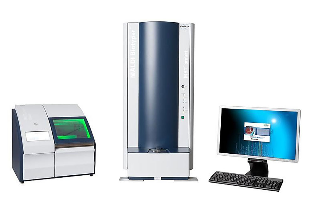 Image: The Microflex Biotyper MALDI-TOF Mass Spectrometry System for fast, accurate and cost-effective microbial identification (Photo courtesy of Bruker Daltonics)