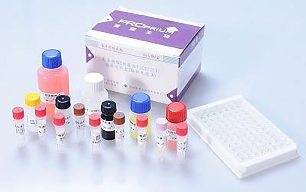 Image: The Proprium Fibro-CHI Diagnostic ELISA Kit for the quantification of Chitinase 3-Like 1 (CHI3L1) in serum and plasma (Photo courtesy of Proprium Biotech Company Limited)