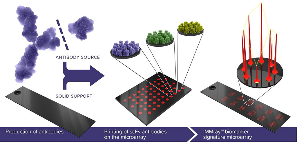 Image: Schematic diagram of the IMMray PanCan-d assay that relies on the IMMray microarray technology, where single chain fragment antibodies are printed onto a slide in a measured amount as a microarray of different antibody biomarkers (Photo courtesy of Immunovia)